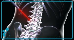 لیزر پرتوان در گیلاوند و دماوند